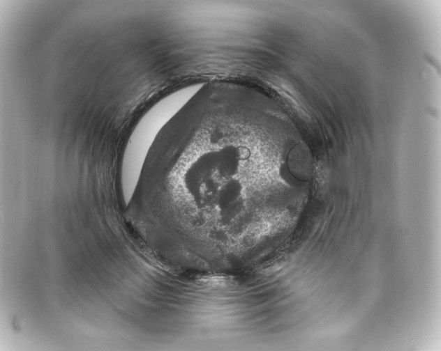 X0000098150499200805081045