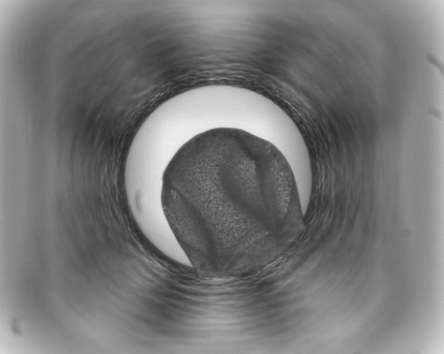 X0000098150514200805081045
