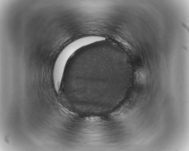 X0000098150517200805081045