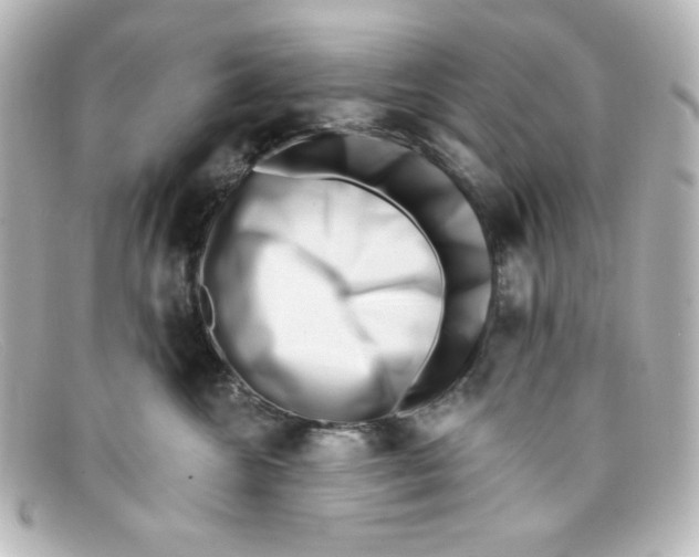 X0000098150572200805081044