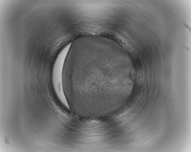 X0000098150594200805081043