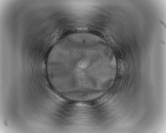 X0000098150614200805081043