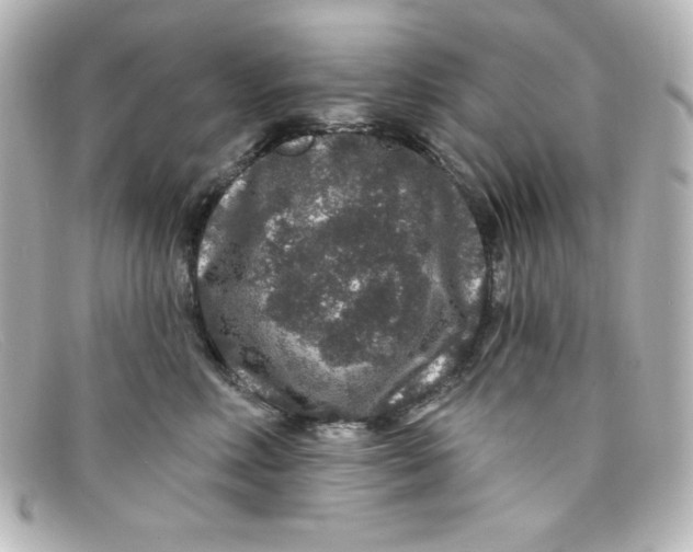 X0000098150618200805081043