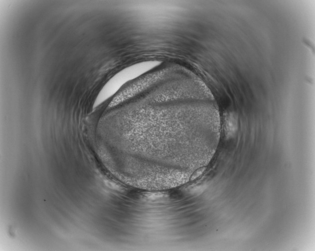 X0000098150619200805081043