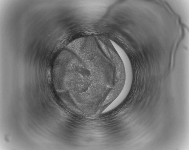 X0000098150699200805081042