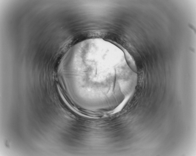 X0000098150716200805081042