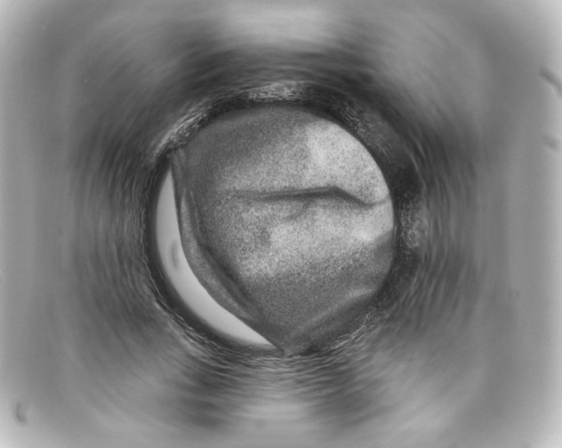 X0000098150735200805081041