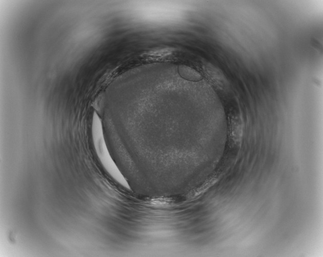 X0000098150758200805081042