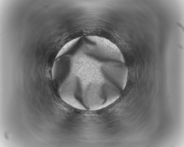X0000098150770200805081041