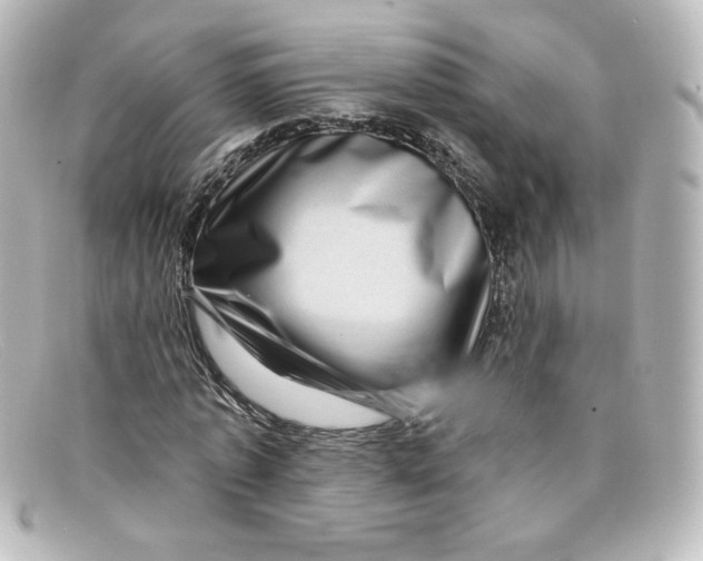 X0000098150773200805081041
