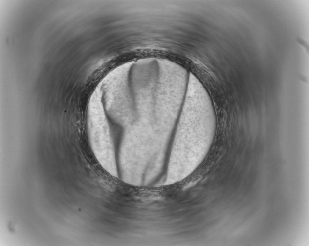 X0000098150870200805081040