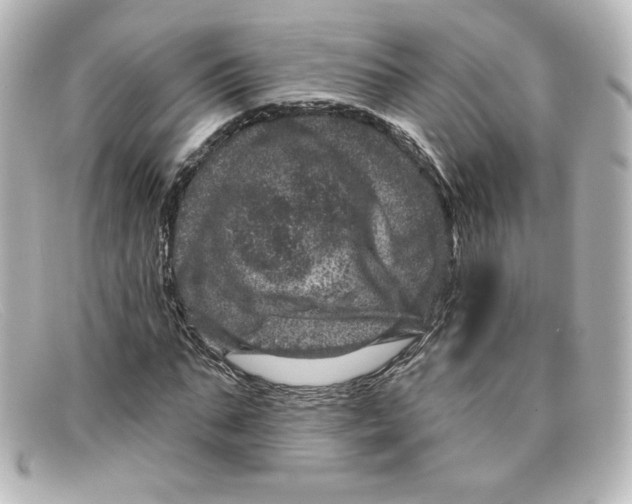 X0000098150871200805081040
