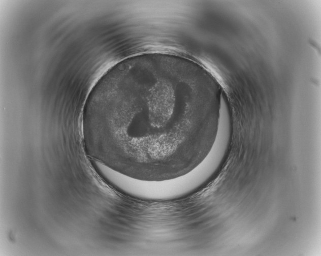 X0000098150891200805081039