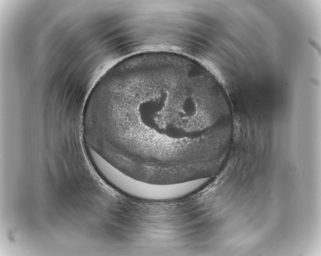 X0000098150895200805081039