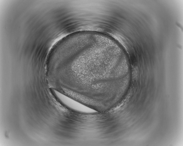 X0000098150971200805081038