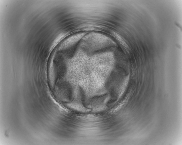 X0000098150986200805081038