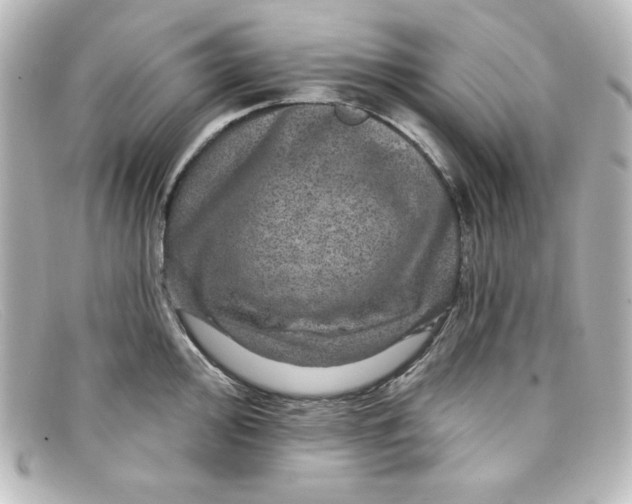 X0000098151000200805081038