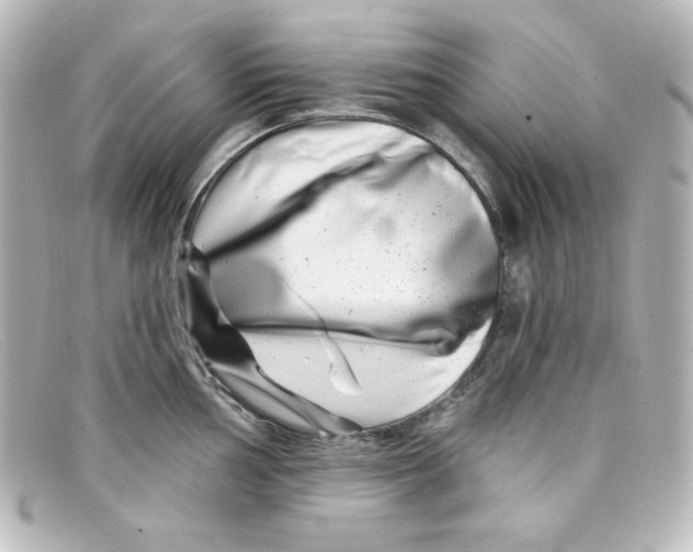X0000098151002200805081038