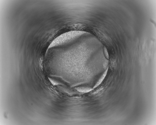 X0000098151010200805081037