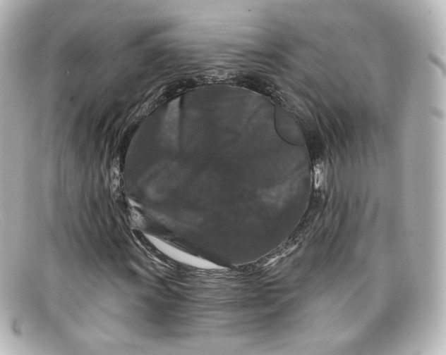 X0000098151011200805081037
