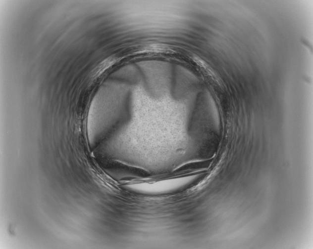 X0000098151017200805081037