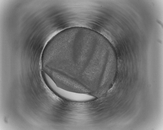 X0000098151028200805081037