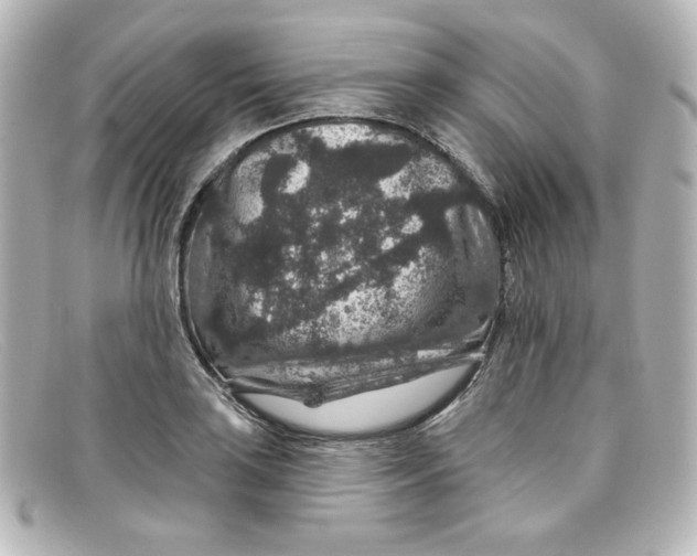 X0000098151035200805081037