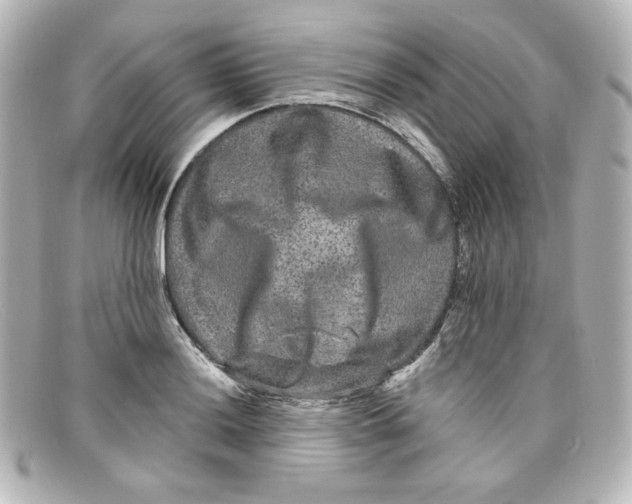 X0000098151036200805081037