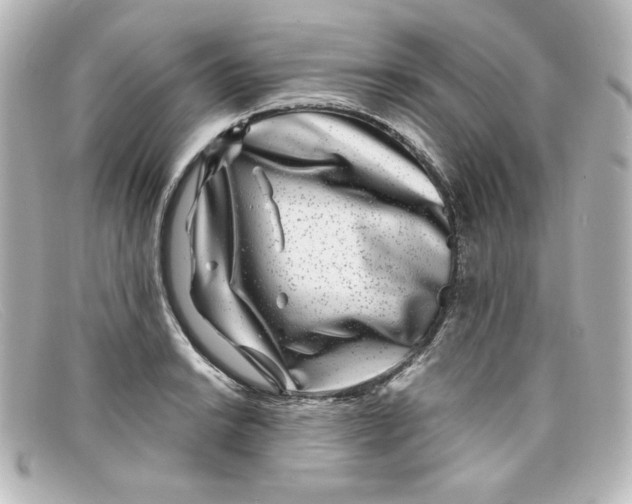 X0000098151038200805081037
