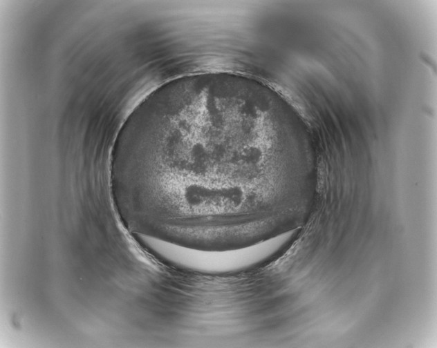 X0000098151039200805081037