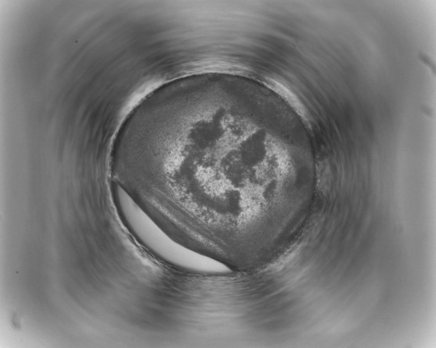X0000098151043200805081037