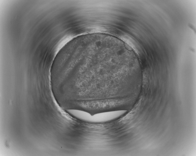 X0000098151047200805081037
