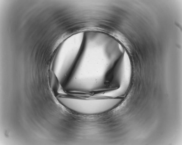 X0000098151049200805081038