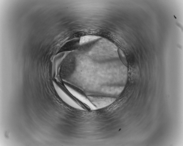 X0000098151058200805081037