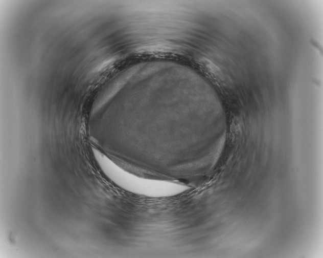 X0000098151062200805081037