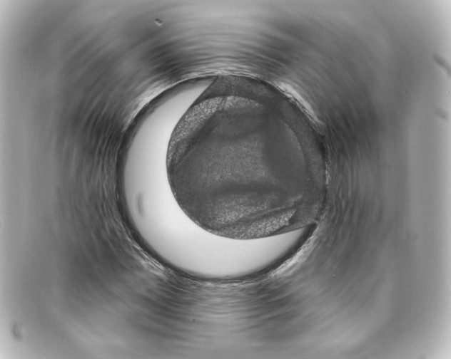 X0000098151065200805081037