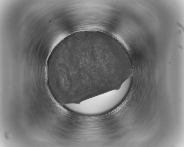 X0000098151079200805081037