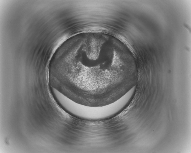 X0000098151083200805081037