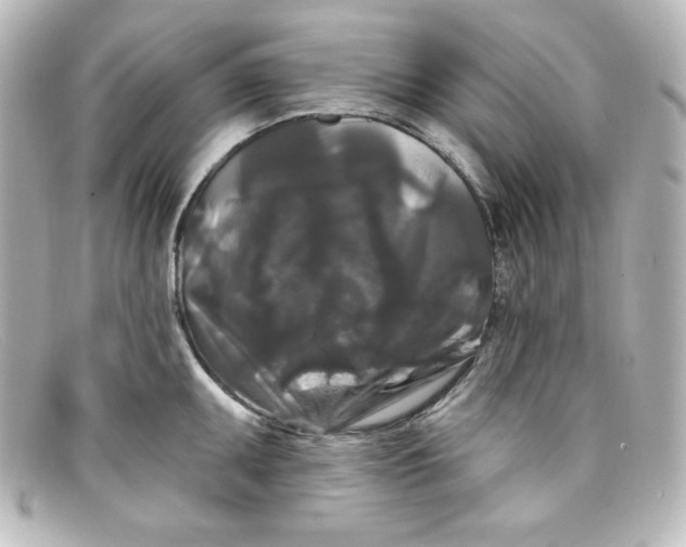 X0000098151095200805081036