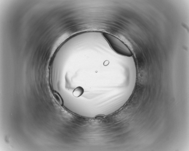 X0000098151096200805081036