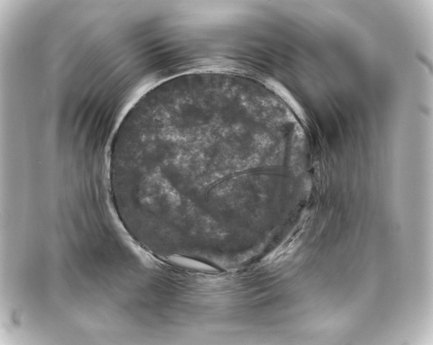 X0000098151099200805081036