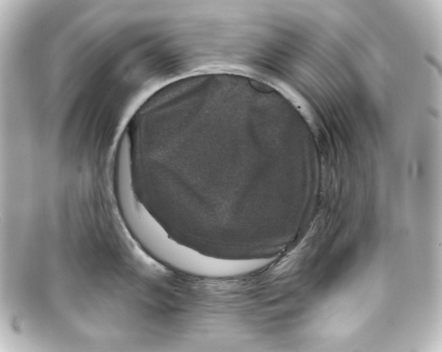 X0000098151102200805081036