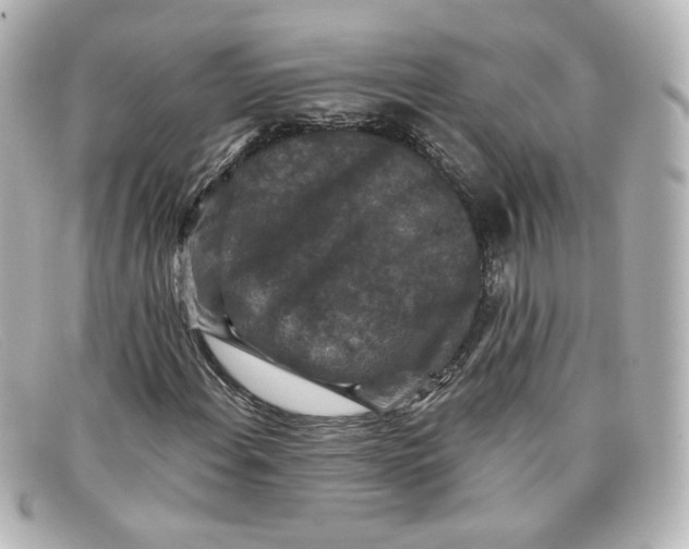 X0000098151108200805081036