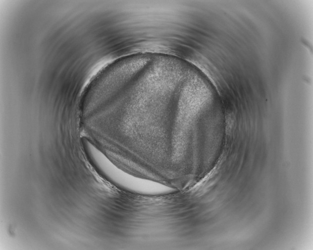 X0000098151115200805081036
