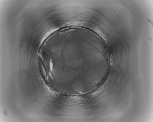 X0000098151117200805081036