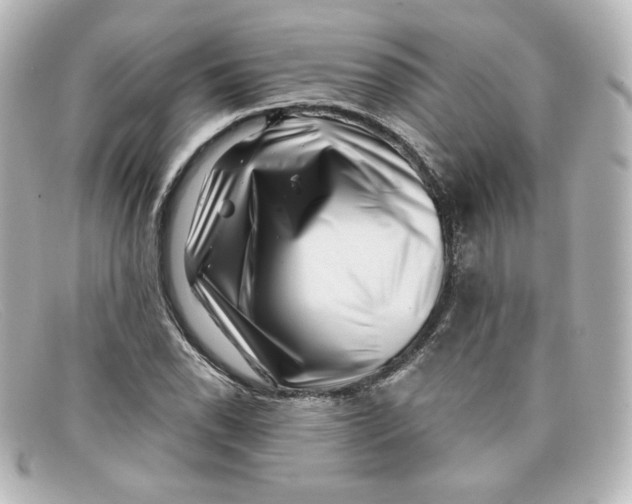 X0000098151118200805081036