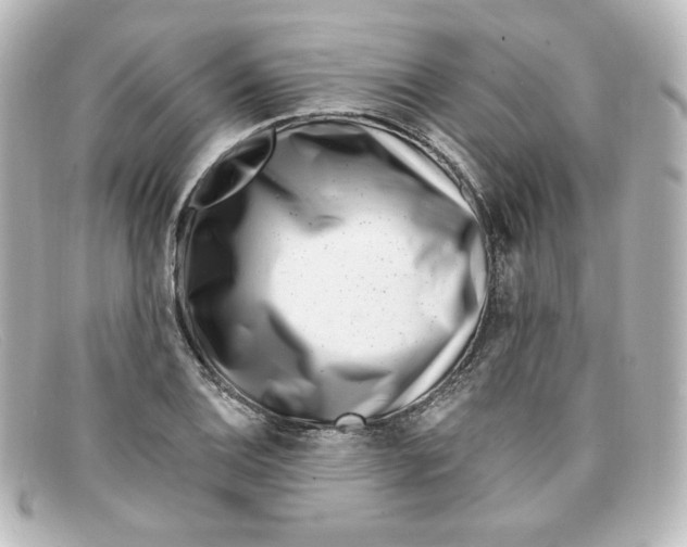X0000098151124200805081036