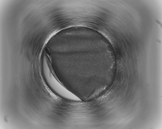 X0000098151127200805081036