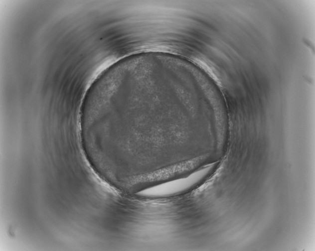 X0000098151133200805081036