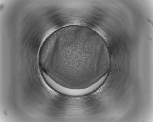X0000098151135200805081036
